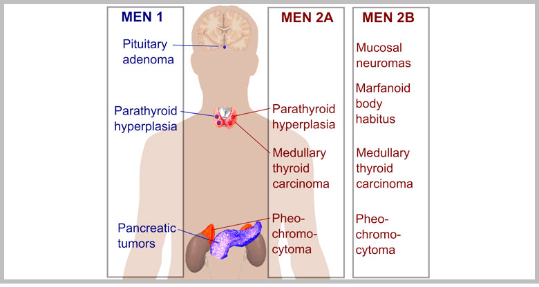 img_MEN-1-2A--2B